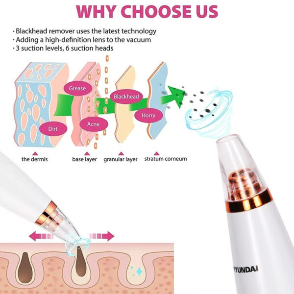 HYUNDAI Rechargeable Electric Blackhead Remover Vacuum FC-038 WH